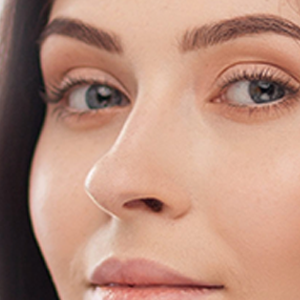 Relleno de Ojeras