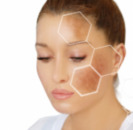 Tratamiento Peeling ácido Retinoico