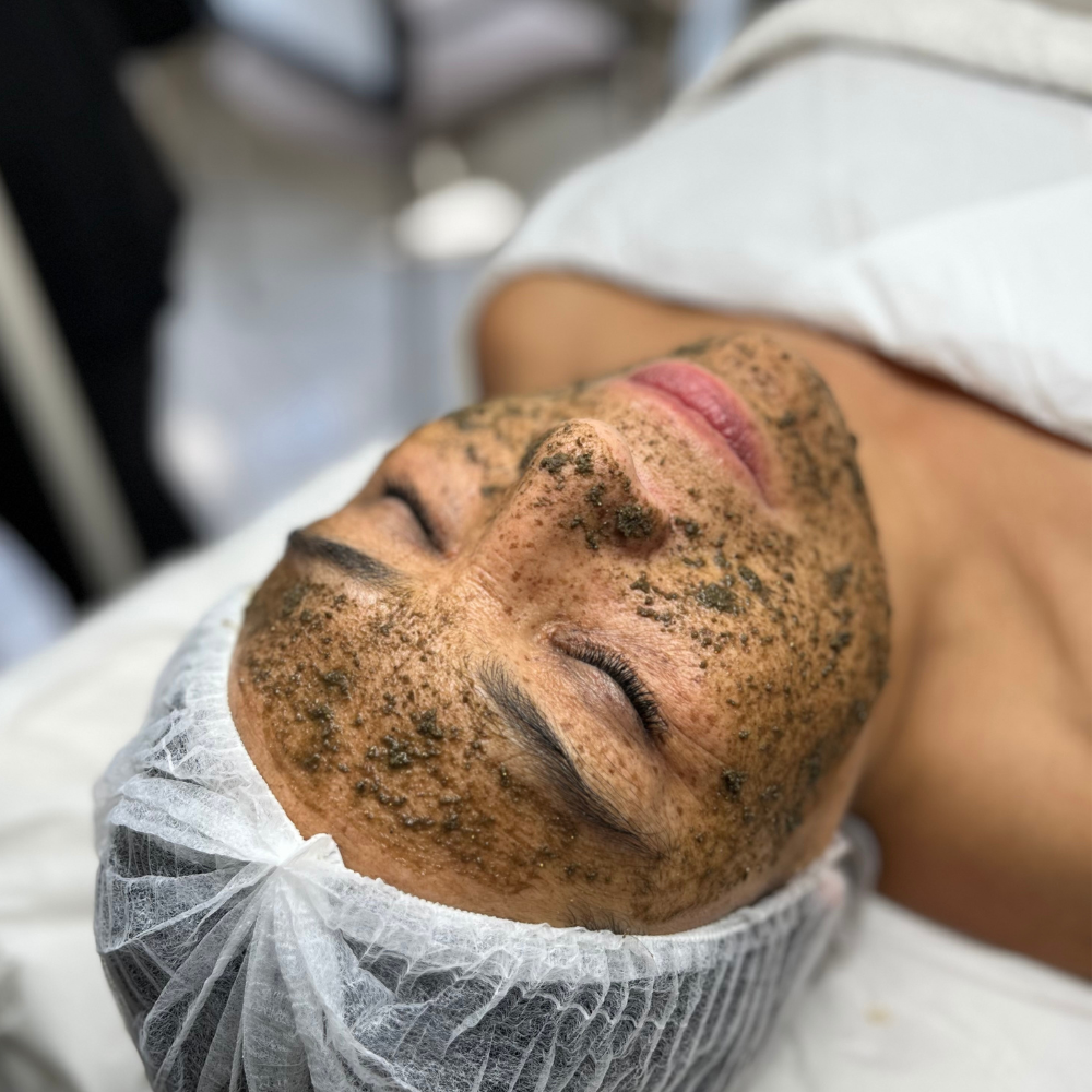 Tratamiento Despigmentante de Peeling Orgánico Coreano